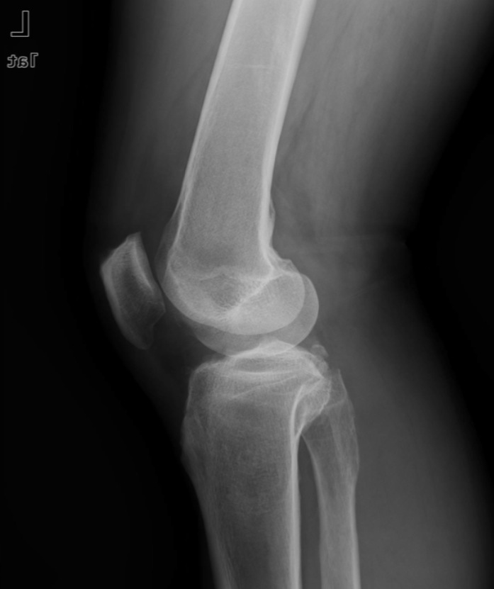 Figure 2 for case arcuate sign